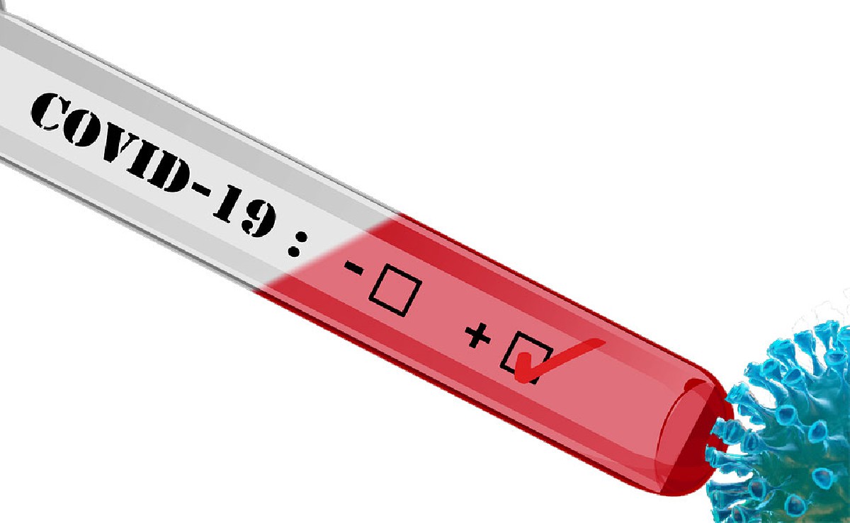 F66C14Daae384Add4749C63Ccf7A1C93Testcovidcoronaviruspositiu